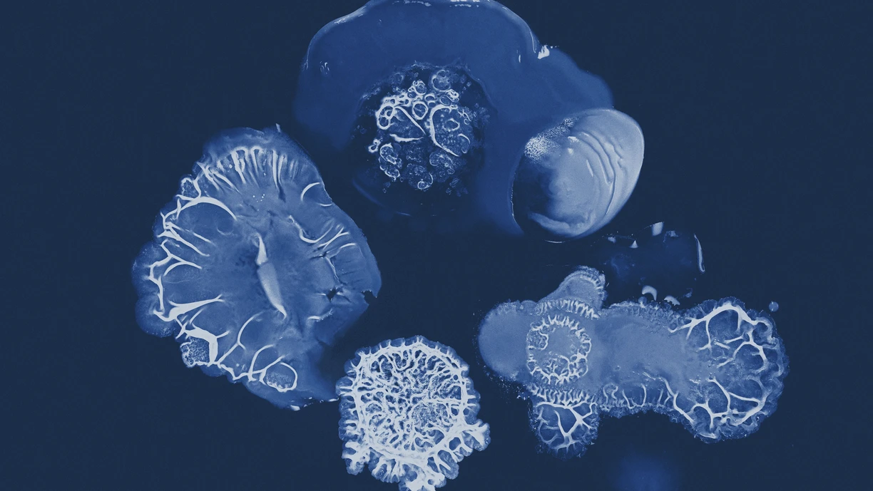Microbial