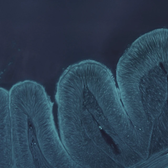 biofilm