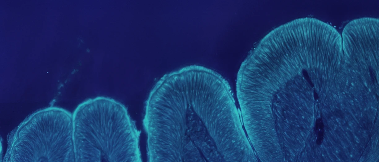 gut interaction