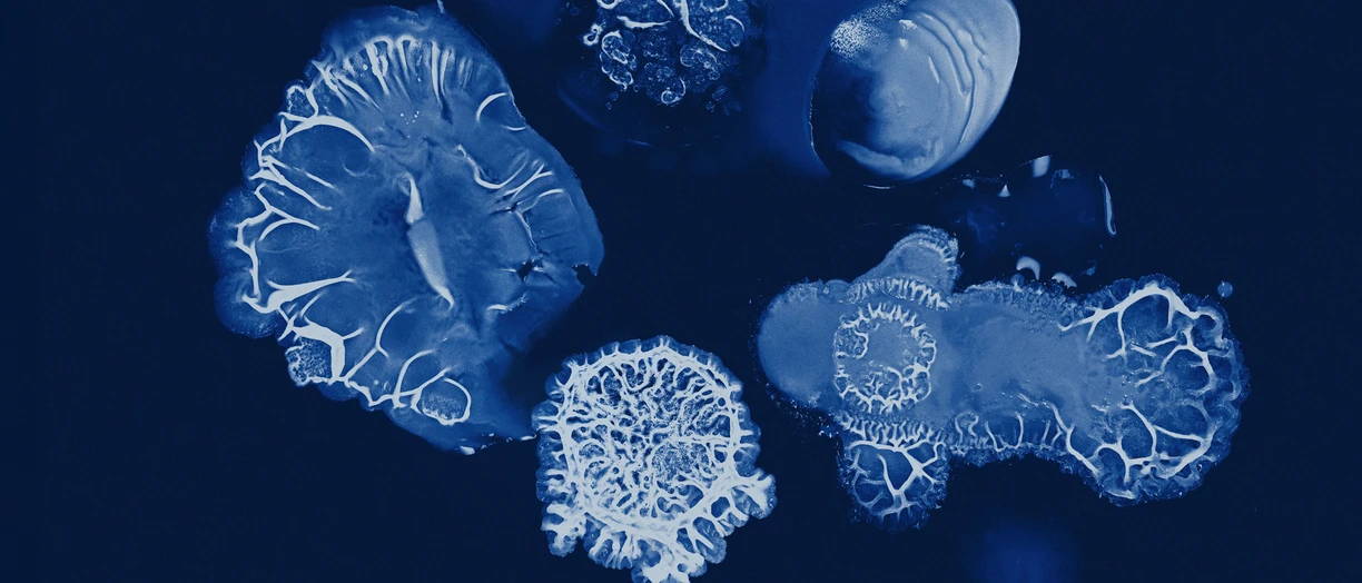 strain microscope