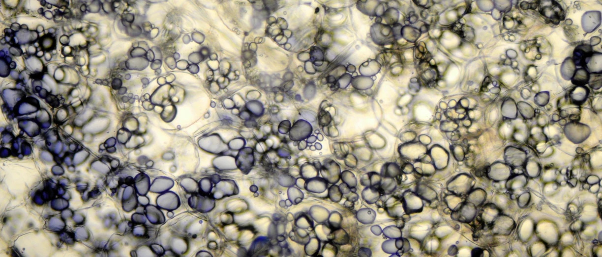 starch under microscope