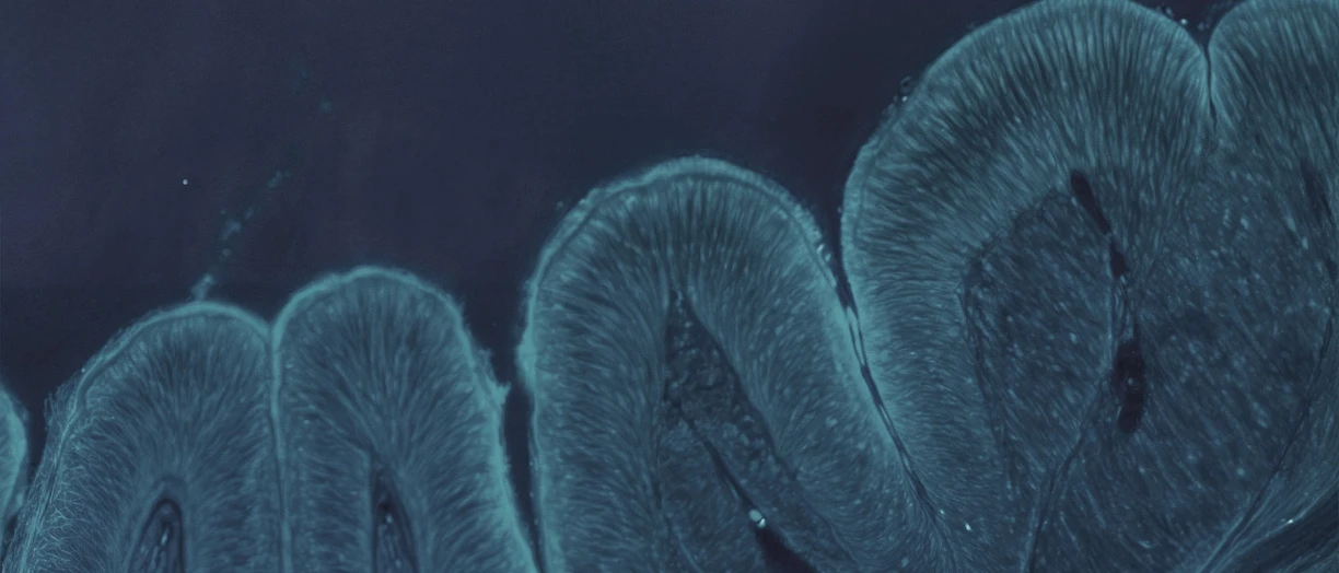 biofilm