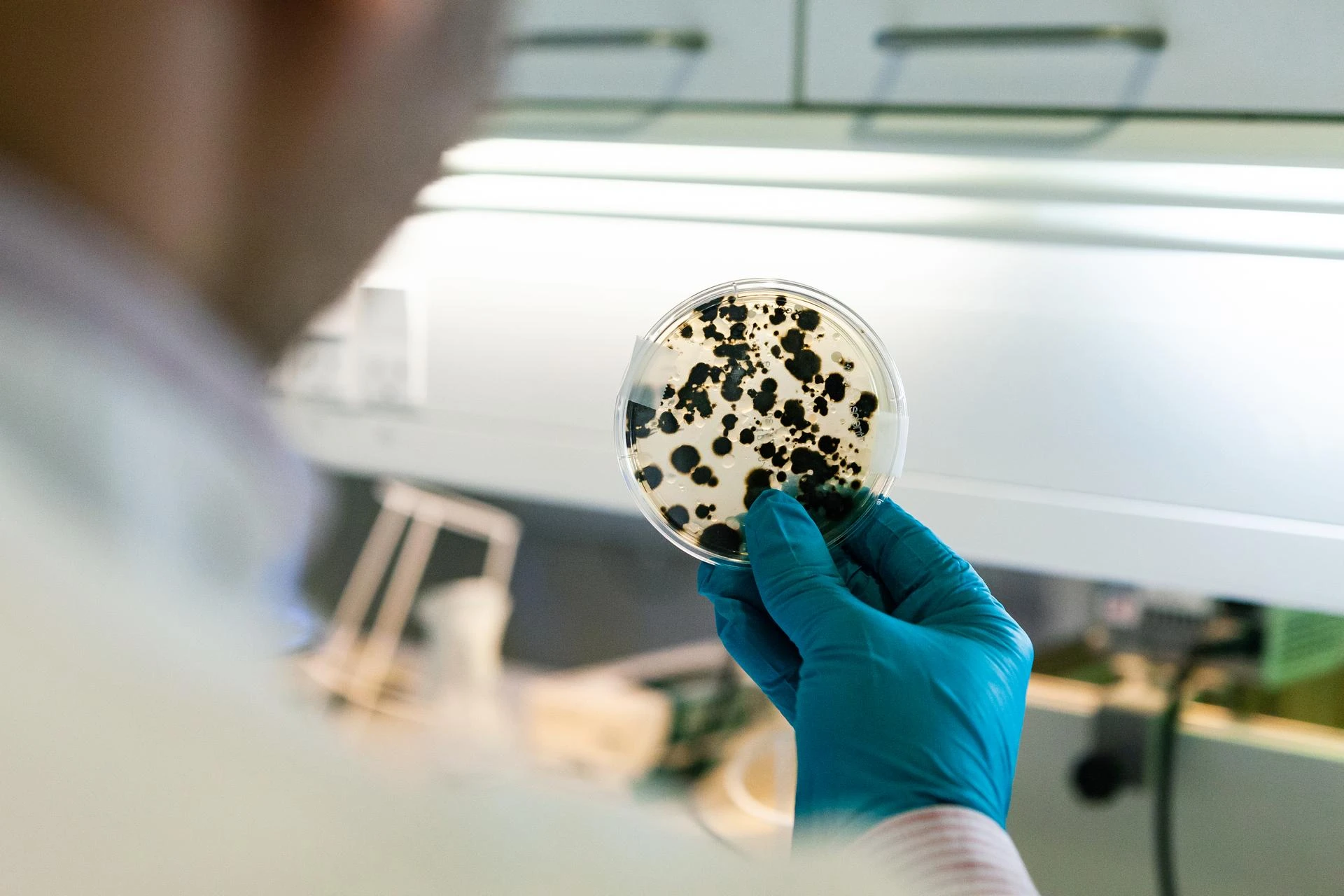 Yeast-and-mold-petri-dish