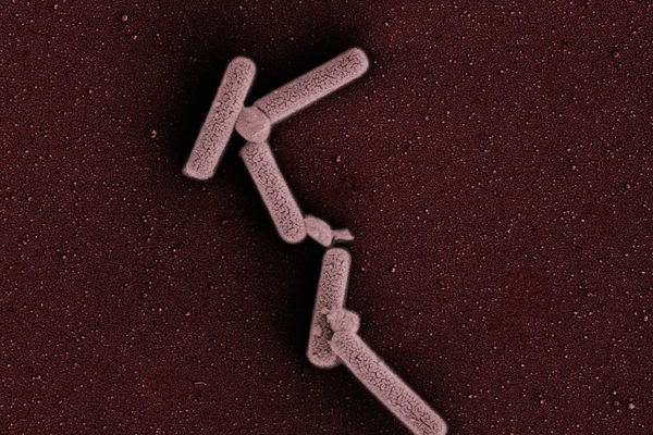Microbial_image_6008_Streptococcus_thermophilus_Sand_Fresh_Dairy 1 copy.jpg