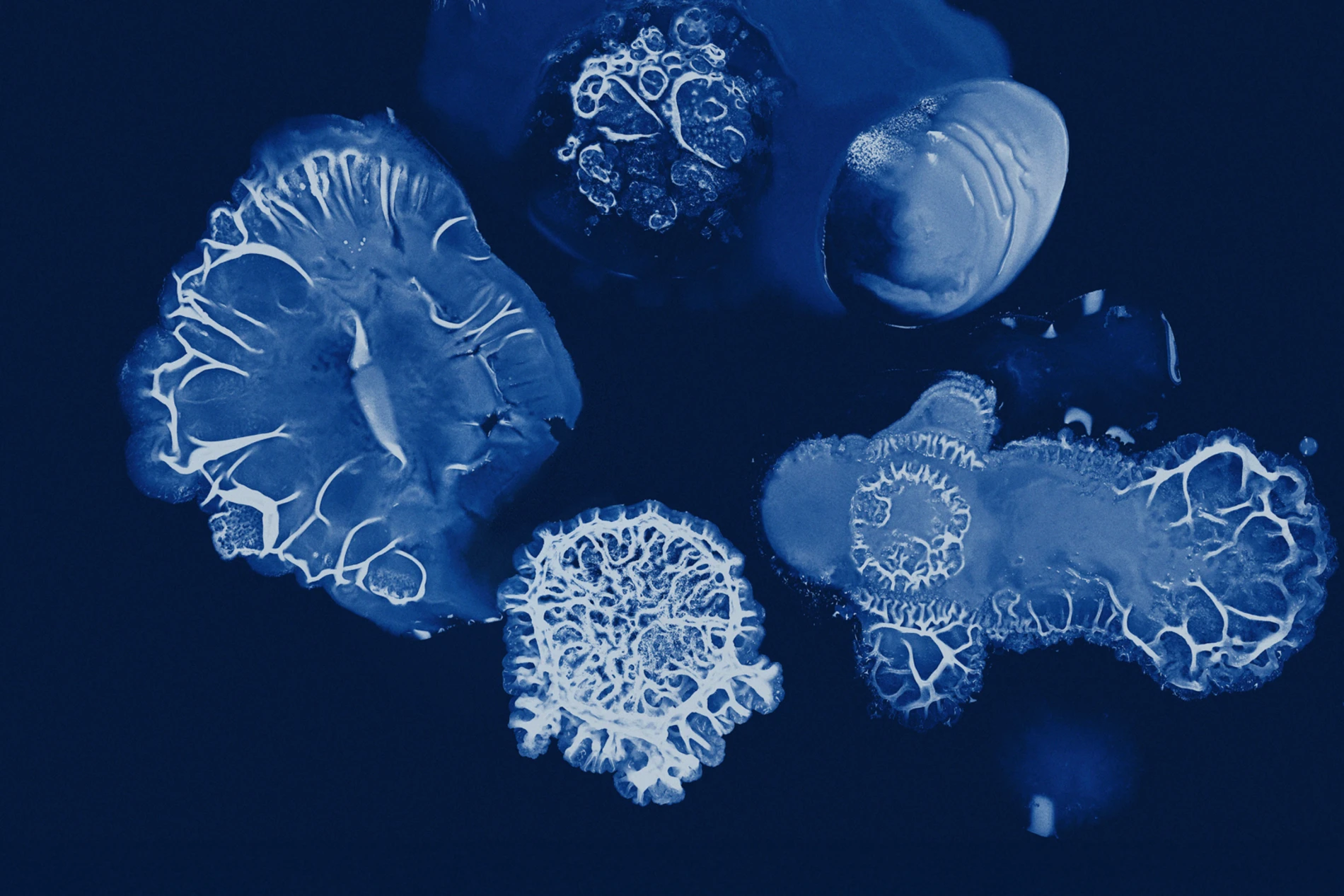 strain microscope