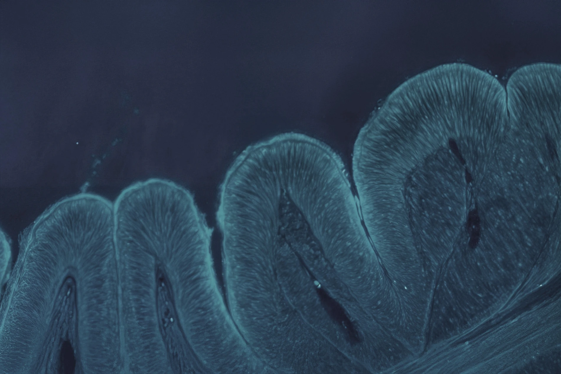 biofilm